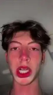 Young Man's Sunburnt Face & Funny Expression